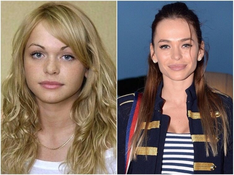 Анна Хилькевич - до и после 