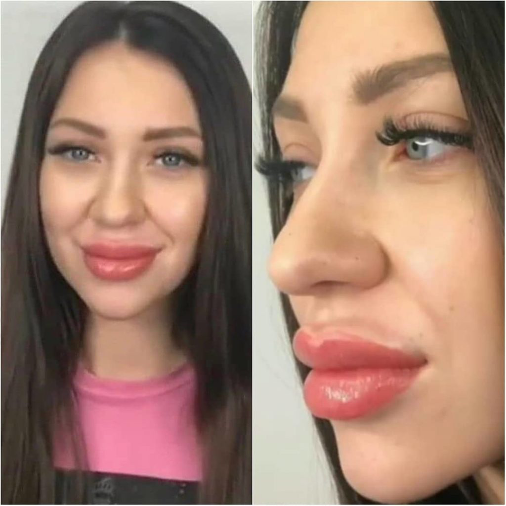 У какого животного большие губы