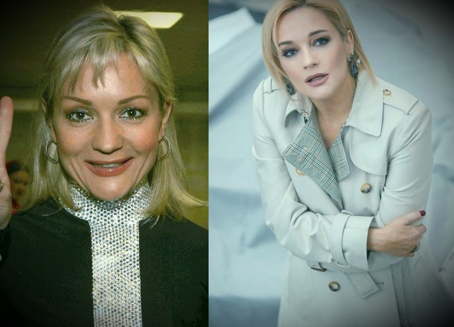 Татьяна Буланова до и после пластики Пластик-Клуб - все о пластике Дзен