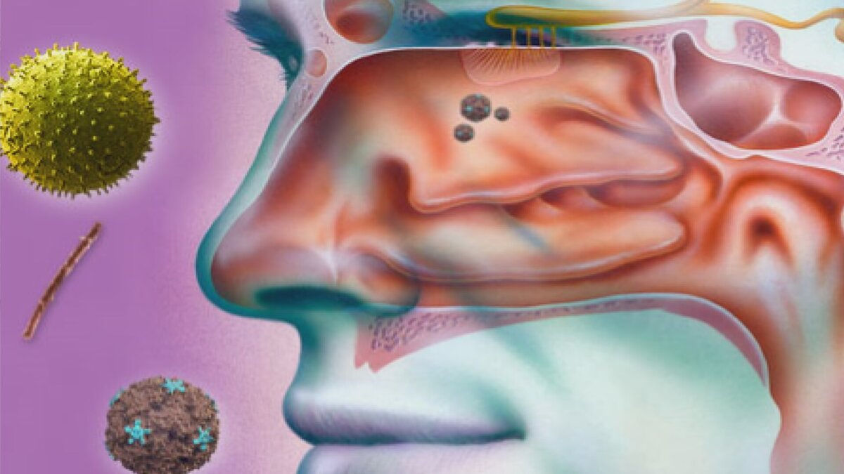 Сложное строение носа