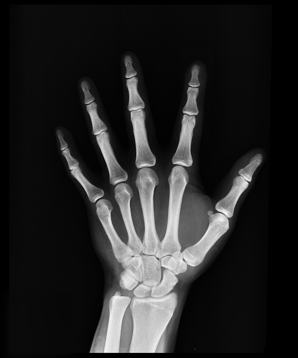 Открытие рентгеновского излучения | MKA History | Дзен