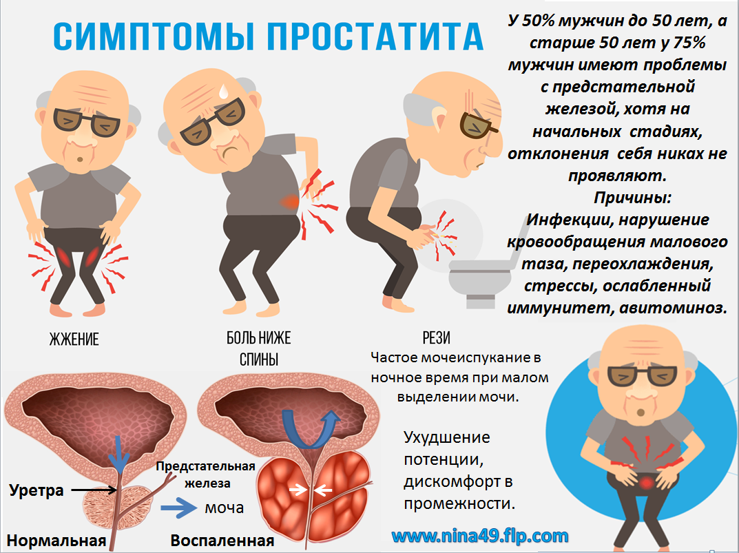 Рак предстательная железа у мужчин симптомы лечение. Простатиты у мужчин симп.