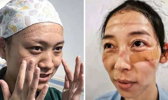 Последствия круглосуточного ношения защиты у персонала больницы