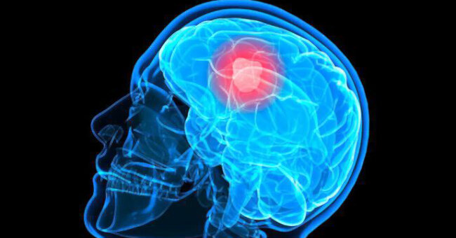 Общие сведения