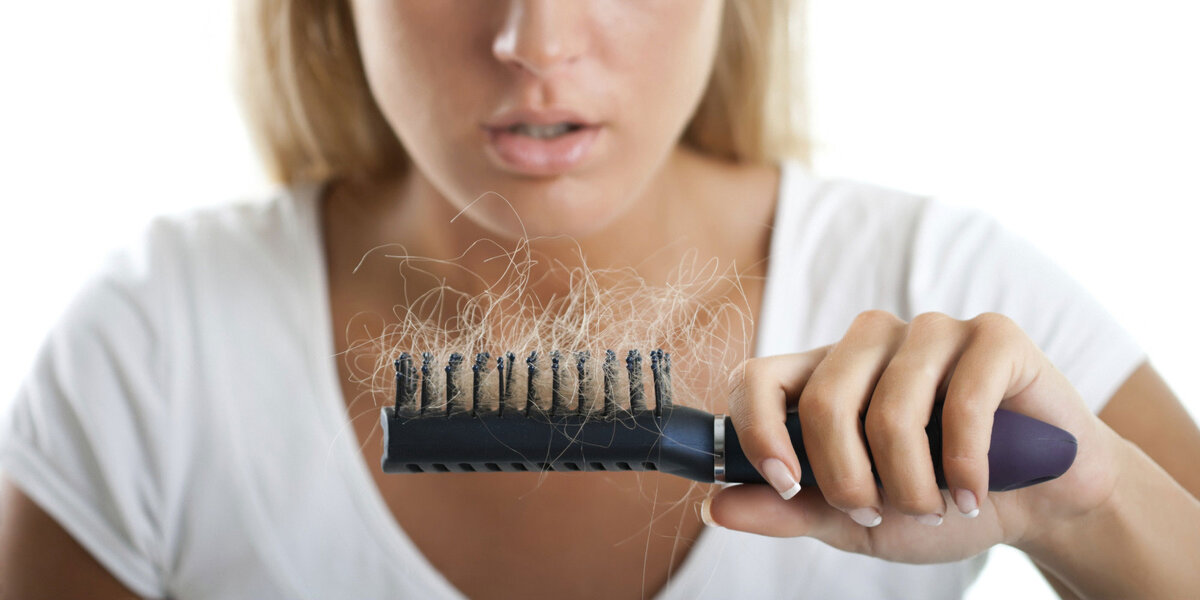  Выпадение волос (алопеция) может быть как физиологическим, так и патологическим.