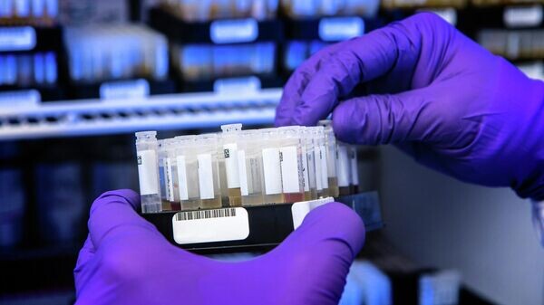   © Photo : Unsplash / CDC