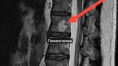 Два упражнения для раскрепощения и вытяжения шейного отдела позвоночника