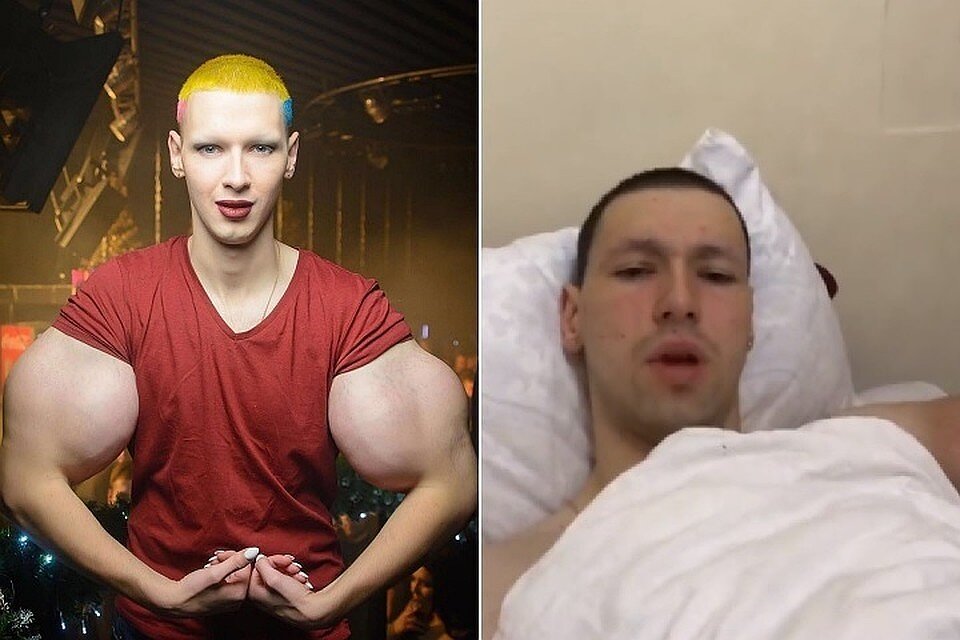 Руки базуки