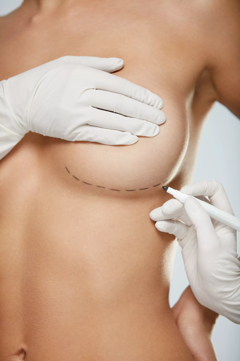 как делают пластическую операцию груди женщин фото 7