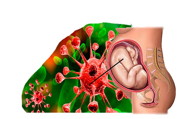 Внутриутробные инфекции плода презентация