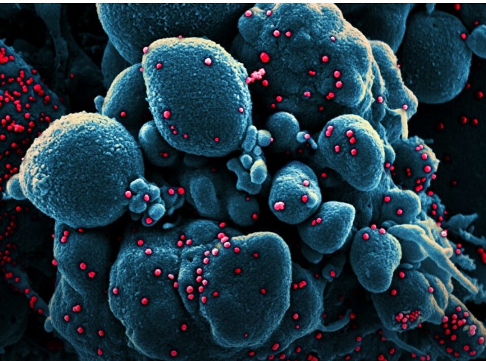 Коронавирус атакует клетки организма. Фто из Google photos. 