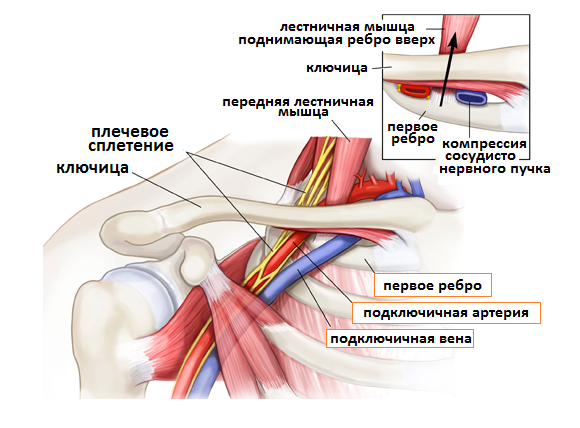 Плечевое сплетение проходит через мышцы шеи под ключицей мимо грудной стенкой.
