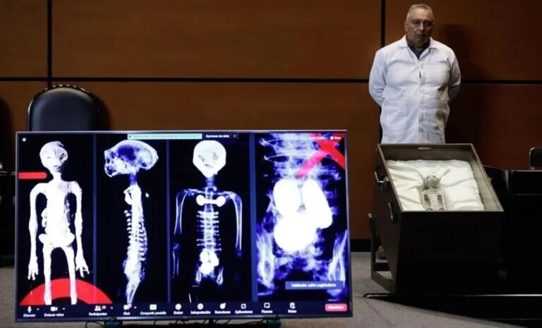     Рентгеновские снимки инопланетянина / © Diego Simón / El Universal