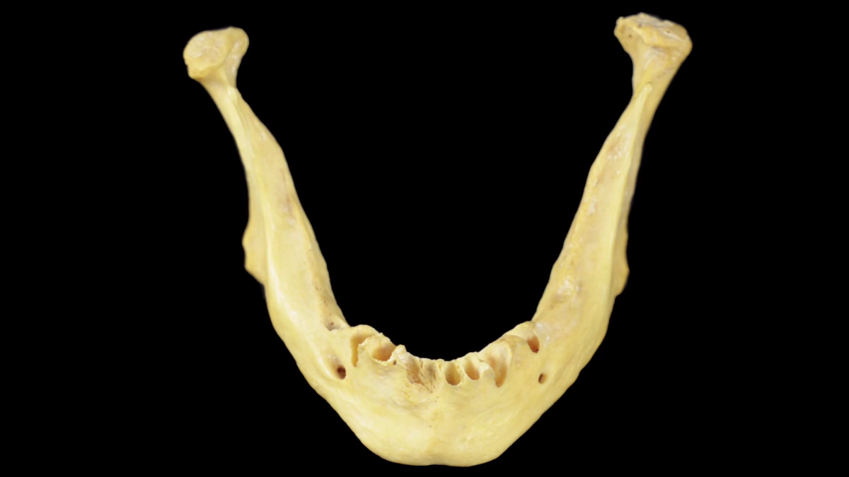 Отдел скелета челюсти. Подбородочное отверстие нижней челюсти. Mandibula скгыеуф. Нижняя челюсть. Нижняя челюсть кость.