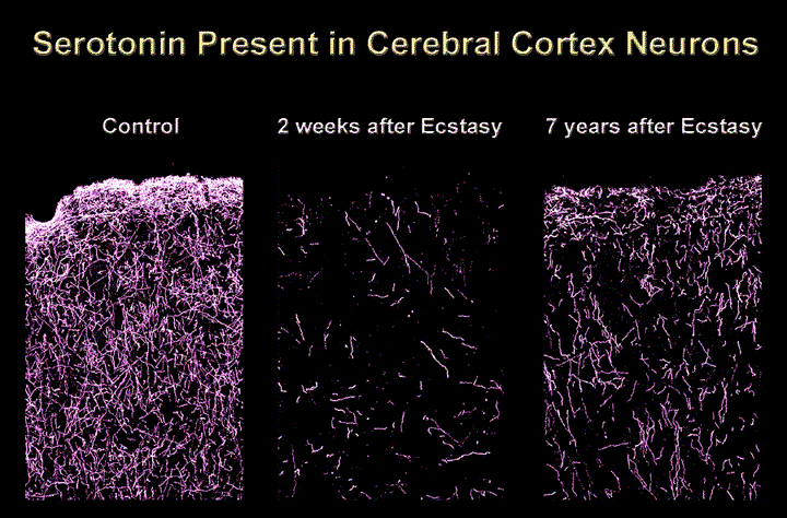 Когда мы их точечно стимулируем веществами вроде ЛСД, ДМТ и всякими похожими штуками. Они не бъют объемами, не повышают весь серотонин, а лишь имитируют его молекулы и крепко крепятся к некоторым его рецепторам. Вот эти рецепторы и могут проседать. Объемами бъет Экстази, но и там тоже замешан дофамин и восстановление серотонина до нормы может быть очень долгим (1, 2). Для большинства людей эти варианты отпадают.