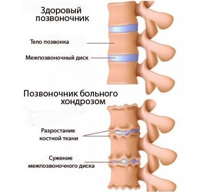 Медовый массаж — Клиника здоровья в Месягутово