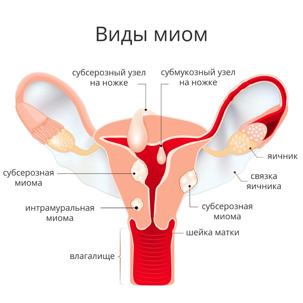 Как остановить сильное кровотечение