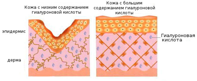 Что такое растительный аналог гиалурона?