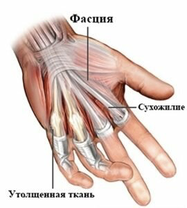 рис. 1  Анатомия кисти