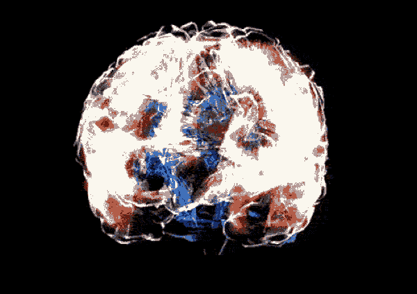 Brain Neuroscience GIF By University Of California