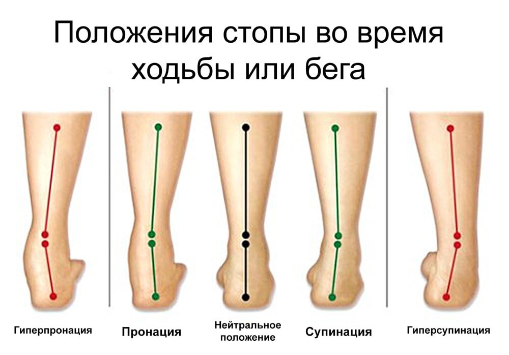 Положение стопы