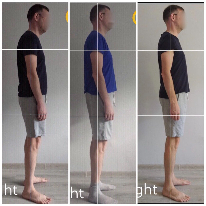 Трансформация осанки за 3 месяца занятий