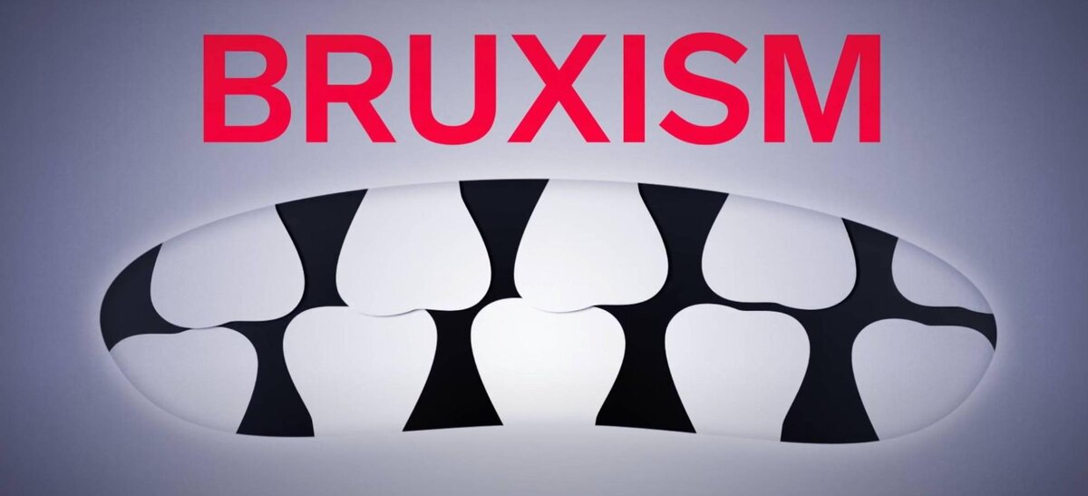 Бруксизм – анимация от автора.