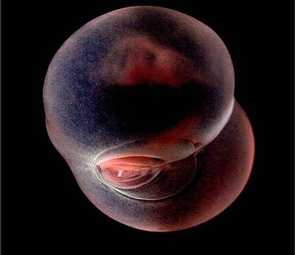 Похож или не похож на пятую точку? Пиши в комментариях! 