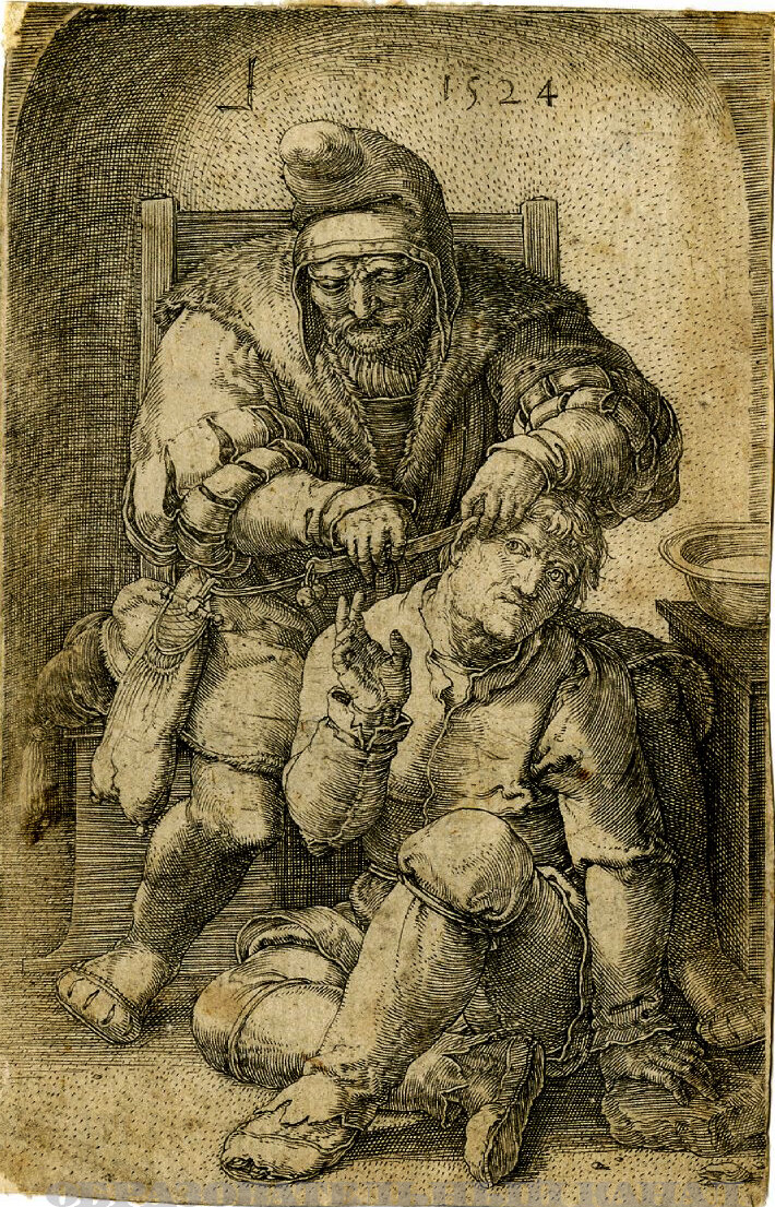 Операция на ухе. Лукас ван Лейден, 1524 г.