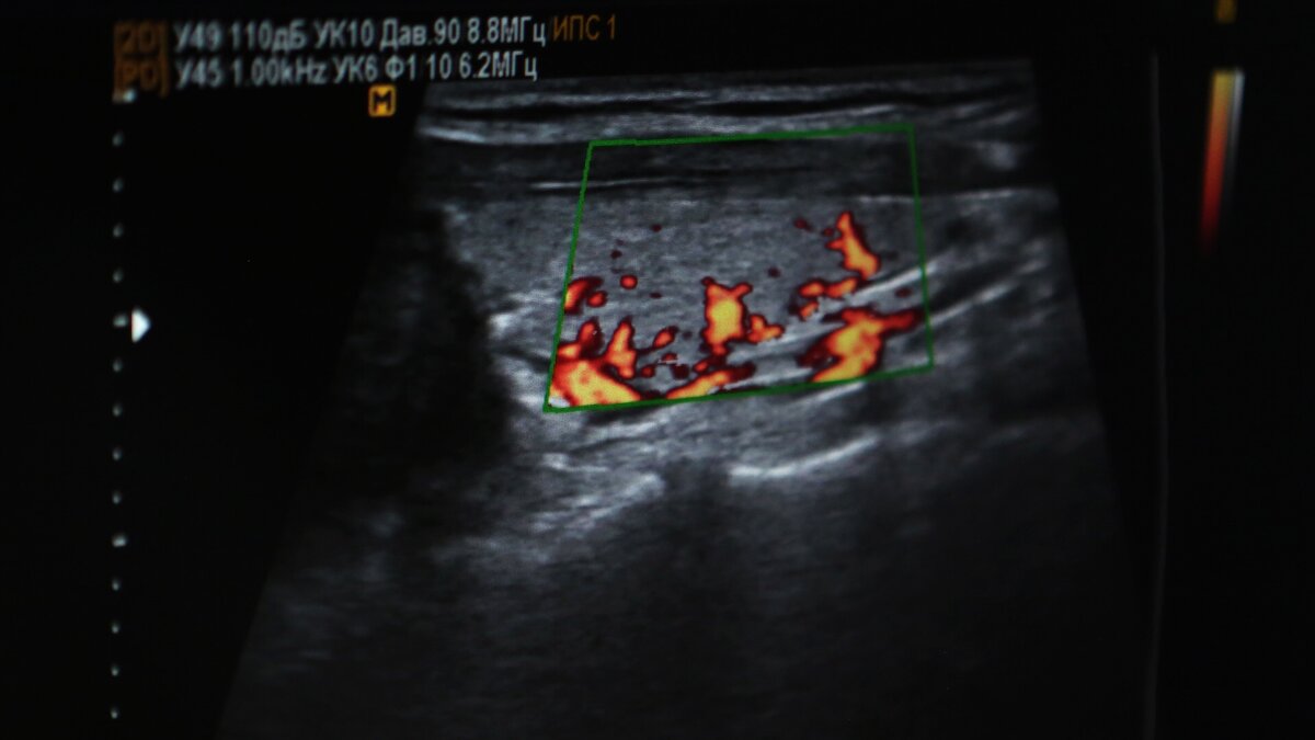 Почему УЗИ проводится в темноте? | Медицинская компания «ЛабСтори» | Дзен