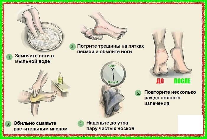 Это нога кого надо нога картинки