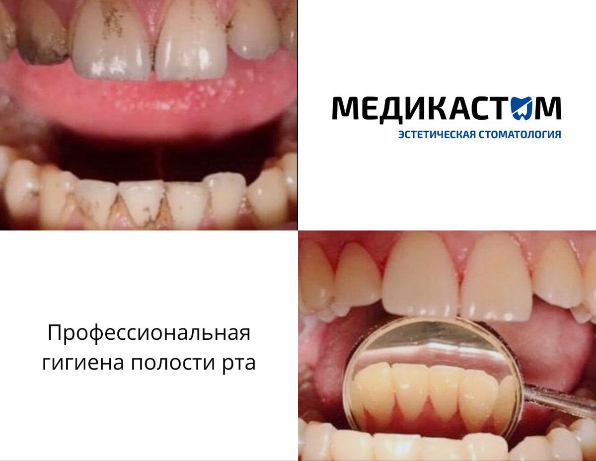 Отбеливание, лечение зубов и другие услуги предоставляются с использованием современного оборудования и материалов.