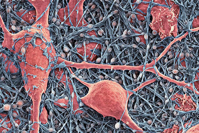 Thomas Deerinck, NCMIR