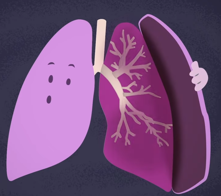 Рекомендации при астме