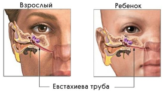 Вопрос: почему в самолёте болят уши и как избавиться от неприятных ощущений? - sauna-chelyabinsk.ru