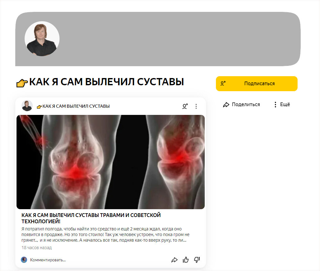 Так выглядят каналы "суставников"