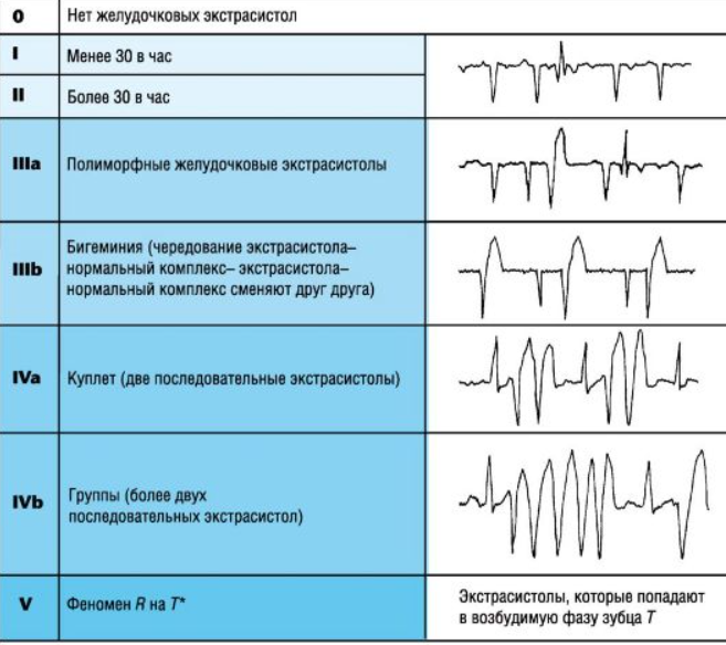 Классификация желудочковых экстрасистол. Классификация желудочковых экстрасистол по Лауну-Вольфу. Желудочковая экстрасистолия 2 градации по Лауну. Желудочковая экстрасистолия по Лауну.