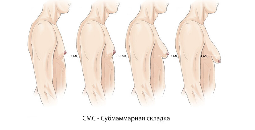 Как меняется женская грудь в течение жизни? | EUROLAZER