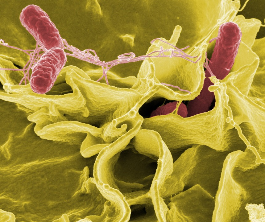 https://pixabay.com/photos/salmonella-bacteria-macro-549608/