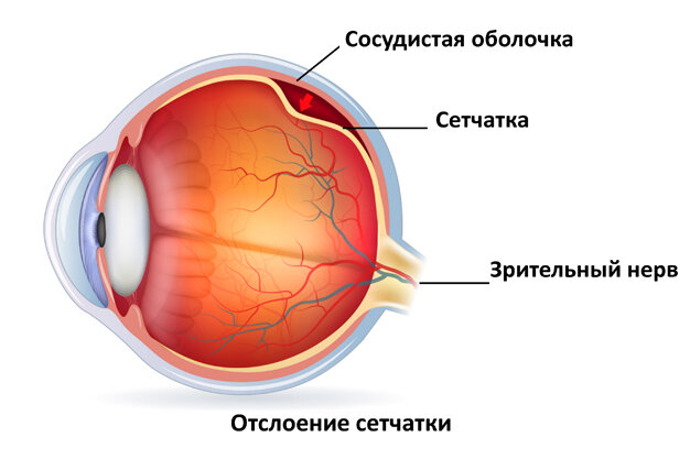 Может ли упасть зрение на нервной почве?