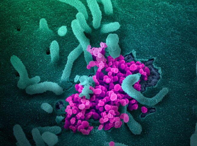 Снимок коронавирусной инфекции COVID-19 под микроскопом. Национальный институт аллергии и инфекционных заболеваний США.