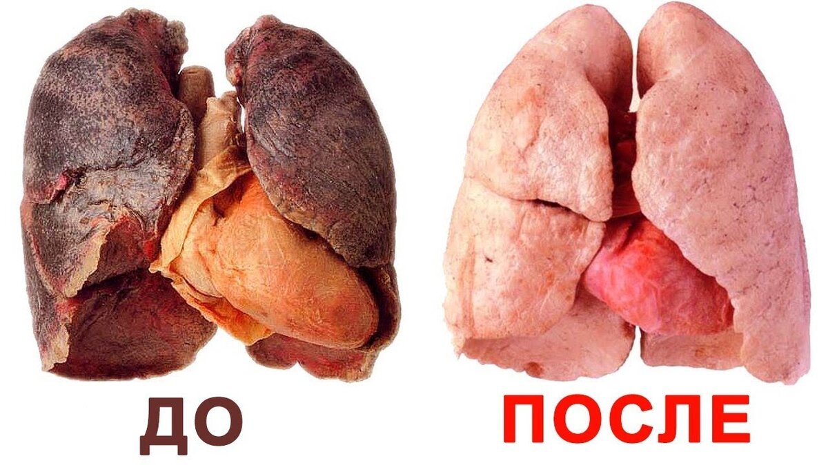 Вот,чего ВЫ можете добиться за НЕСКОЛЬКО месяцев!