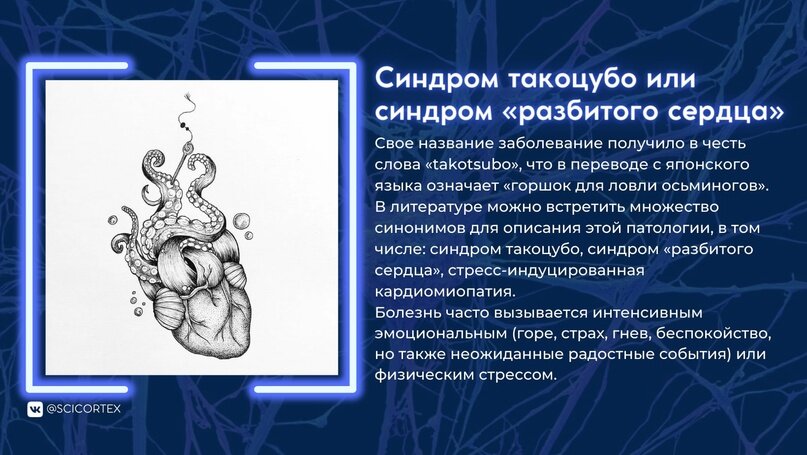 Наглядное изображение кардиомиопатии такоцубо.