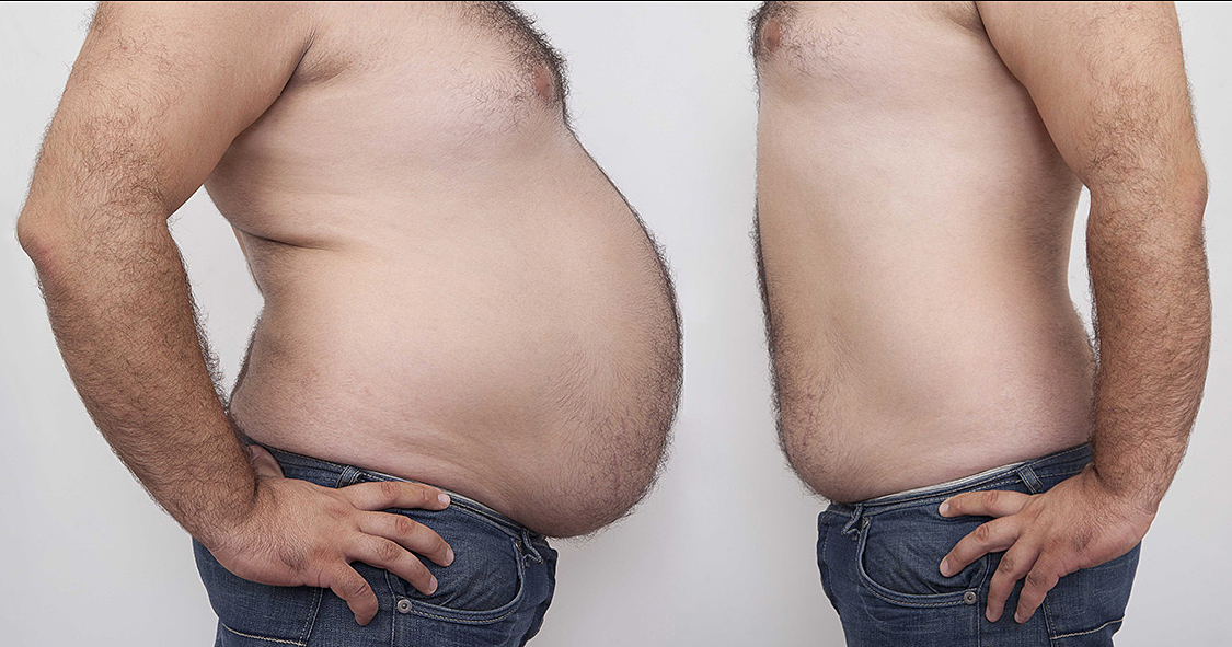 3 главные причины, мешающие убрать жир на животе: мнение диетологов