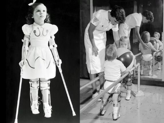 Так выглядят дети после полиомиелита. Фото 50-х годов. Понимаете, почему мы сейчас это не видим?
