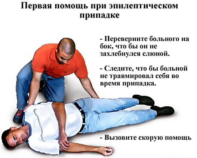 Как выглядит эпилепсия у человека