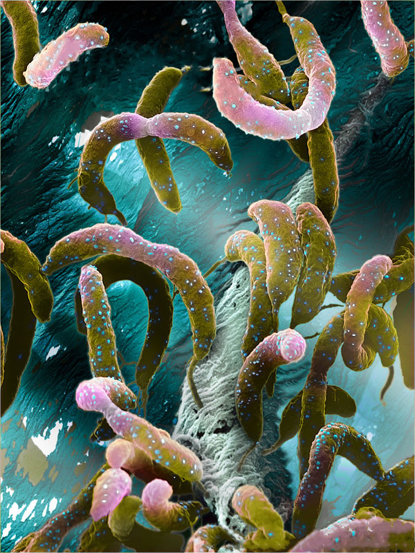 https://evrenvebilim.com/wp-content/uploads/2017/02/Caulobacter-Crescentus.jpg