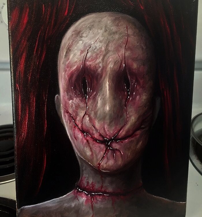Рисунок больного