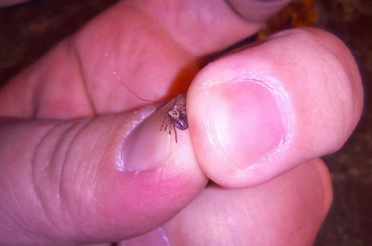 клещ, разбудивший воронежца

Автор фото: читатель «МОЁ! Online»