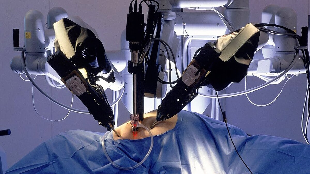 Рак простаты роботом. Робот-хирург da Vinci в России. DAVINCI робот хирургия. Современные роботы в медицине. Робот да Винчи операции.